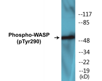 Western blot analysis of extracts from HepG2 cells, using WASP (Phospho-Tyr290) Antibody.