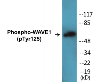 Western blot analysis of extracts from NIH-3T3 cells treated with Insulin 0.01U/ml 15', using WAVE1 (Phospho-Tyr125) Antibody.