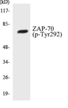 Western blot analysis of extracts from Jurkat cells treated with UV 15', using ZAP-70 (Phospho-Tyr292) Antibody.