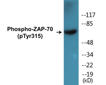Western blot analysis of extracts from Jurkat cells treated with Ca+ 40nM 30', using ZAP-70 (Phospho-Tyr315) Antibody.