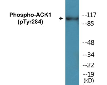 Western blot analysis of extracts from HepG2 cells treated with EGF 200ng/ml 30', using ACK1 (Phospho-Tyr284) Antibody.