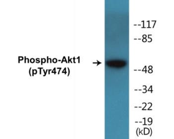 Western blot analysis of extracts from COS7 cells treated with UV 15', using Akt (Phospho-Tyr474) Antibody.-