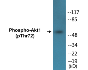 Western blot analysis of extracts from NIH-3T3 cells treated with TNF-a 20ng/ml 30', using Akt (Phospho-Thr72) Antibody.
