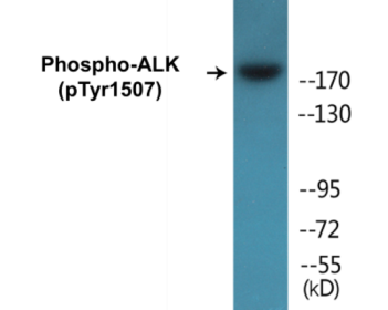 Western blot analysis of extracts from COS7 cells treated with anisomycin 25ug/ml 30', using ALK (Phospho-Tyr1507) Antibody.