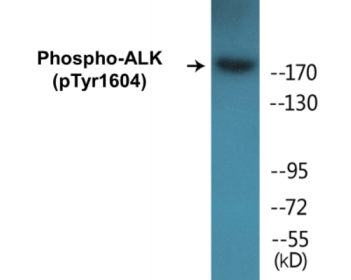 Western blot analysis of extracts from HepG2 cells, using ALK (Phospho-Tyr1604) Antibody.