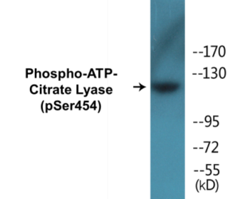 Western blot analysis of extracts from COS7 cells treated with Calyculin 50nM 30', using ATP-Citrate Lyase (Phospho-Ser454) Antibody.
