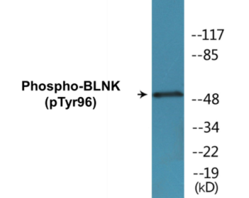 Western blot analysis of extracts from COLO205 cells, using BLNK (Phospho-Tyr96) Antibody.
