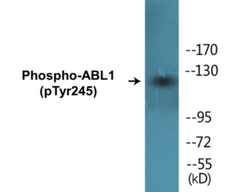 Western blot analysis of extracts from K562 cells treated with Insulin 0.01U/ml 15, using c-Abl (Phospho-Tyr245) Antibody.