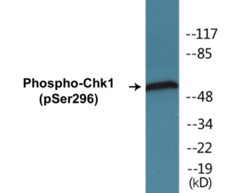 Western blot analysis of extracts from HuvEc cells treated with UV 15', using Chk1 (Phospho-Ser296) Antibody.