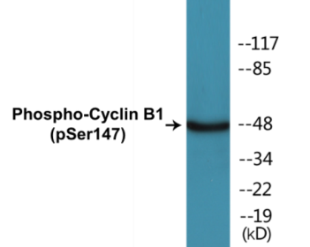 Western blot analysis of extracts from Jurkat cells treated with UV 15', using Cyclin B1 (Phospho-Ser147) Antibody.