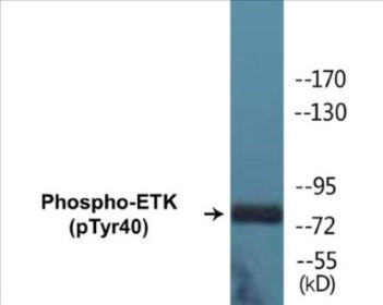 Western blot analysis of extracts from HepG2 cells, using ETK (Phospho-Tyr40) Antibody.
