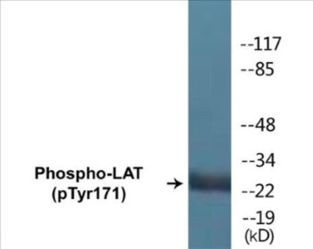 Western blot analysis of extracts from Jurkat cells treated with UV 15', using LAT (Phospho-Tyr171) Antibody.