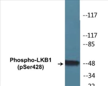 Western blot analysis of extracts from HeLa cells treated with PMA 125ng/ml 30', using LKB1 (Phospho-Ser428) Antibody.