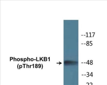 Western blot analysis of extracts from NIH-3T3 cells treated with PMA 125ng/ml 30', using LKB1 (Phospho-Thr189) Antibody.