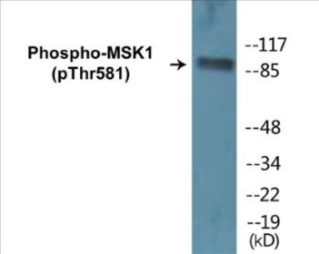 Western blot analysis of extracts from RAW264.7 cells treated with UV 5', using MSK1 (Phospho-Thr581) Antibody.