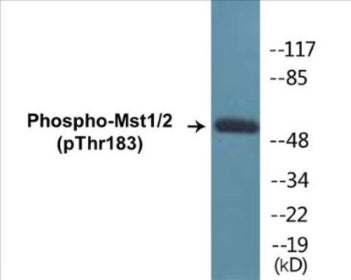 Western blot analysis of extracts from 293 cells treated with H2O2 100uM 15', using Mst1/2 (Phospho-Thr183) Antibody.