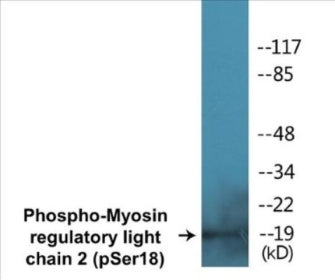 Western blot analysis of extracts from LOVO cells treated with H2O2 100uM 30', using Myosin regulatory light chain 2 (Phospho-Ser18) Antibody.