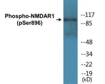 Western blot analysis of extracts from K562 cells treated with PMA 125ng/ml 30', using NMDAR1 (Phospho-Ser896) Antibody.