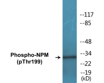 Western blot analysis of extracts from HepG2 cells, using NPM (Phospho-Thr199) Antibody.