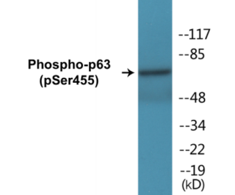 Western blot analysis of extracts from HeLa cells treated with TNF 2500U/ML 30', using p63 (Phospho-Ser455) Antibody.