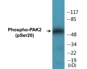Western blot analysis of extracts from 293 cells treated with Sorbitol 0.4M 30', using PAK2 (Phospho-Ser20) Antibody.