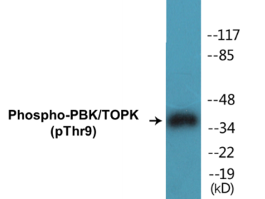 Western blot analysis of extracts from K562 cells treated with UV 30', using PBK/TOPK (Phospho-Thr9) Antibody.