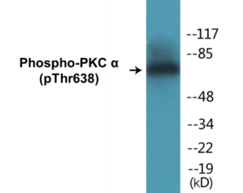 Western blot analysis of extracts from NIH-3T3 cells treated with UV 15', using PKC alpha (Phospho-Thr638) Antibody.