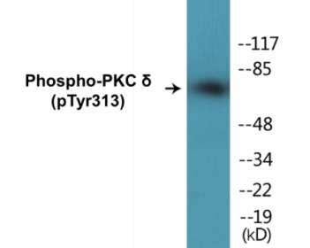 Western blot analysis of extracts from HepG2 cells, COLO205 cells and HuvEc cells, using PKC delta (Phospho-Tyr313) Antibody.