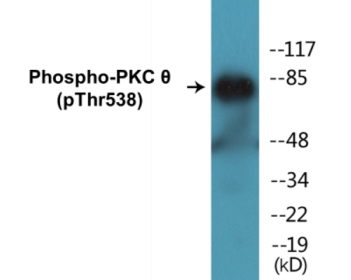 Western blot analysis of extracts from Jurkat cells, using PKC thet (Phospho-Thr538) Antibody.