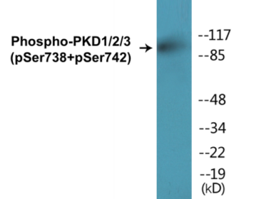 Western blot analysis of extracts from A549 cells treated with PMA 125ng/ml 30' and HT29 cells treated with serum 20% 15', using PKD1/2/3/PKC mu (Phospho-Ser738+Ser742) Antibody.