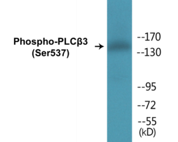 Western blot analysis of extracts from Jurkat cells treated with UV 15', using PLC beta3 (Phospho-Ser537) Antibody.