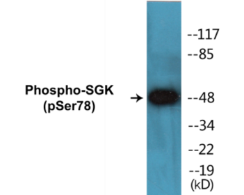 Western blot analysis of extracts from 293 cells treated with UV 15', using SGK (Phospho-Ser78) Antibody.