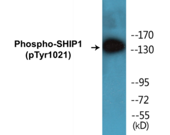 Western blot analysis of extracts from HepG2 cells treated with TNF 200NG/ML 30', using SHIP1 (Phospho-Tyr1021) Antibody.
