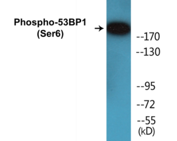 Western blot analysis of extracts from COS7 cells treated with insulin 0.01U/ML 15', using 53BP1 (Phospho-Ser6) Antibody.