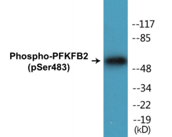 Western blot analysis of extracts from 293 cells treated with Heat shock, using PFKFB2 (Phospho-Ser483) Antibody.