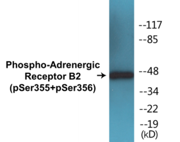 Western blot analysis of extracts from HuvEc cells treated with serum 20% 15' and COS7 cells treated with serum 20% 15', using Adrenergic Receptor B2 (Phospho-Ser355+Ser356) Antibody.