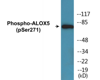Western blot analysis of extracts from HuvEc cells, using Arachidonate 5 Lipoxygenase (Phospho-Ser271) Antibody.