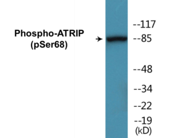 Western blot analysis of extracts from NIH-3T3 cells, using ATRIP (Phospho-Ser68) Antibody.