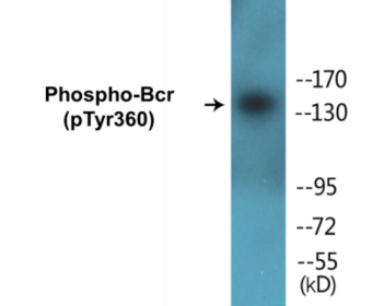 Western blot analysis of extracts from COS7 cells, using Bcr (Phospho-Tyr360) Antibody.
