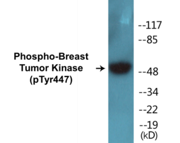 Western blot analysis of extracts from 293 cells treated with EGF 200ng/ml 30', using Breast Tumor Kinase (Phospho-Tyr447) Antibody.