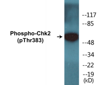 Western blot analysis of extracts from COS7 cells treated with UV 30', using Chk2 (Phospho-Thr383) Antibody.