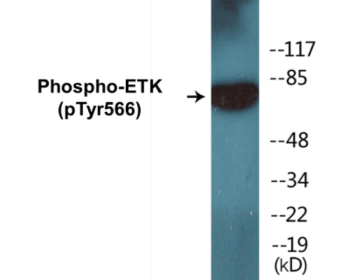Western blot analysis of extracts from HeLa cells treated with Serum 20% 15', using ETK (Phospho-Tyr566) Antibody.