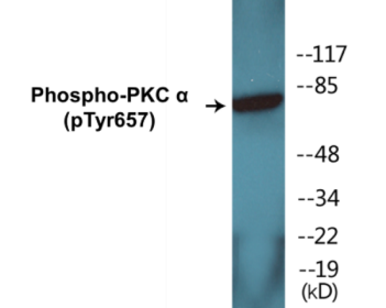 Western blot analysis of extracts from COLO205 cells, using PKC alpha (Phospho-Tyr657) Antibody.