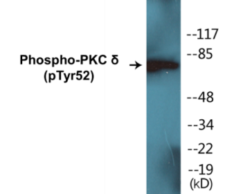 Western blot analysis of extracts from Jurkat cells treated with starved 24h, using PKC delta (Phospho-Tyr52) Antibody.