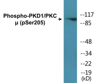 Western blot analysis of extracts from NIH-3T3 cells treated with Anisomycin 25ug/ml 30', using PKD1/PKC mu (Phospho-Ser205) Antibody.