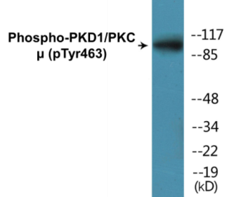 Western blot analysis of extracts from HepG2 cells, using PKD1/PKC mu (Phospho-Tyr463) Antibody.