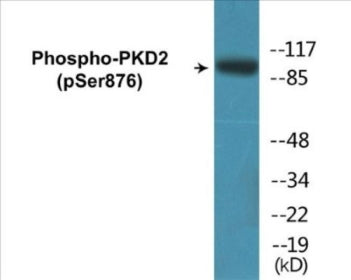 Western blot analysis of extracts from NIH-3T3 cells treated with PMA 250ng/ml 15', using PKD2 (Phospho-Ser876) Antibody.