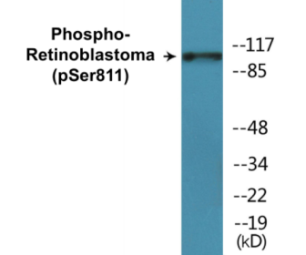 Western blot analysis of extracts from K562 cells, using Retinoblastoma (Phospho-Ser811) Antibody.