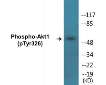 Western blot analysis of extracts from mouse liver, using Akt (Phospho-Tyr326) Antibody.