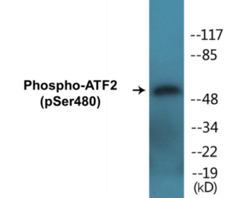 Western blot analysis of extracts from HuvEc cells treated with Anisomycin 25ug/ml 30', using ATF2 (Phospho-Ser480) Antibody.